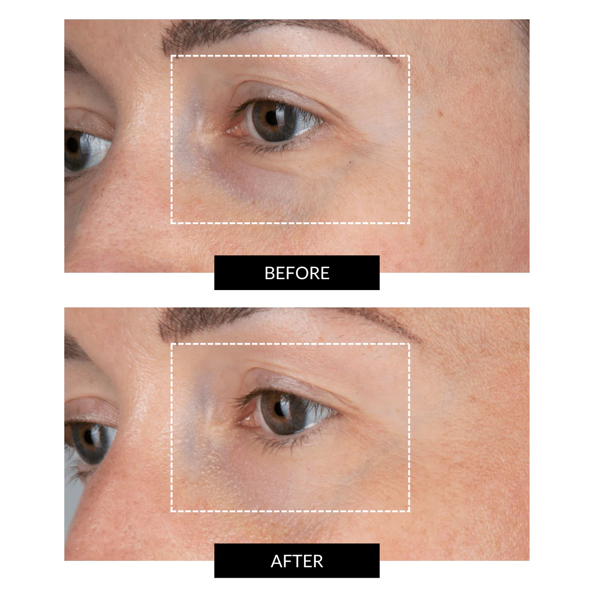 CurrentBody Skin LED Eye Perfector & 5 Eye Hydrogel Masks worth $399 - Image 4