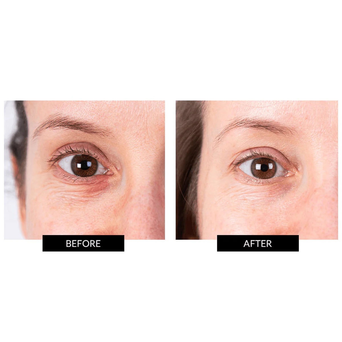 CurrentBody Skin LED Eye Perfector & 5 Eye Hydrogel Masks worth $399 - Image 6